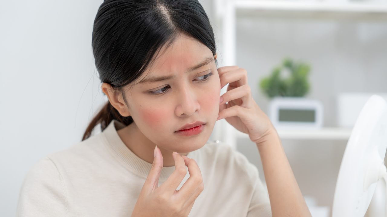 Allergic Contact Dermatitis: