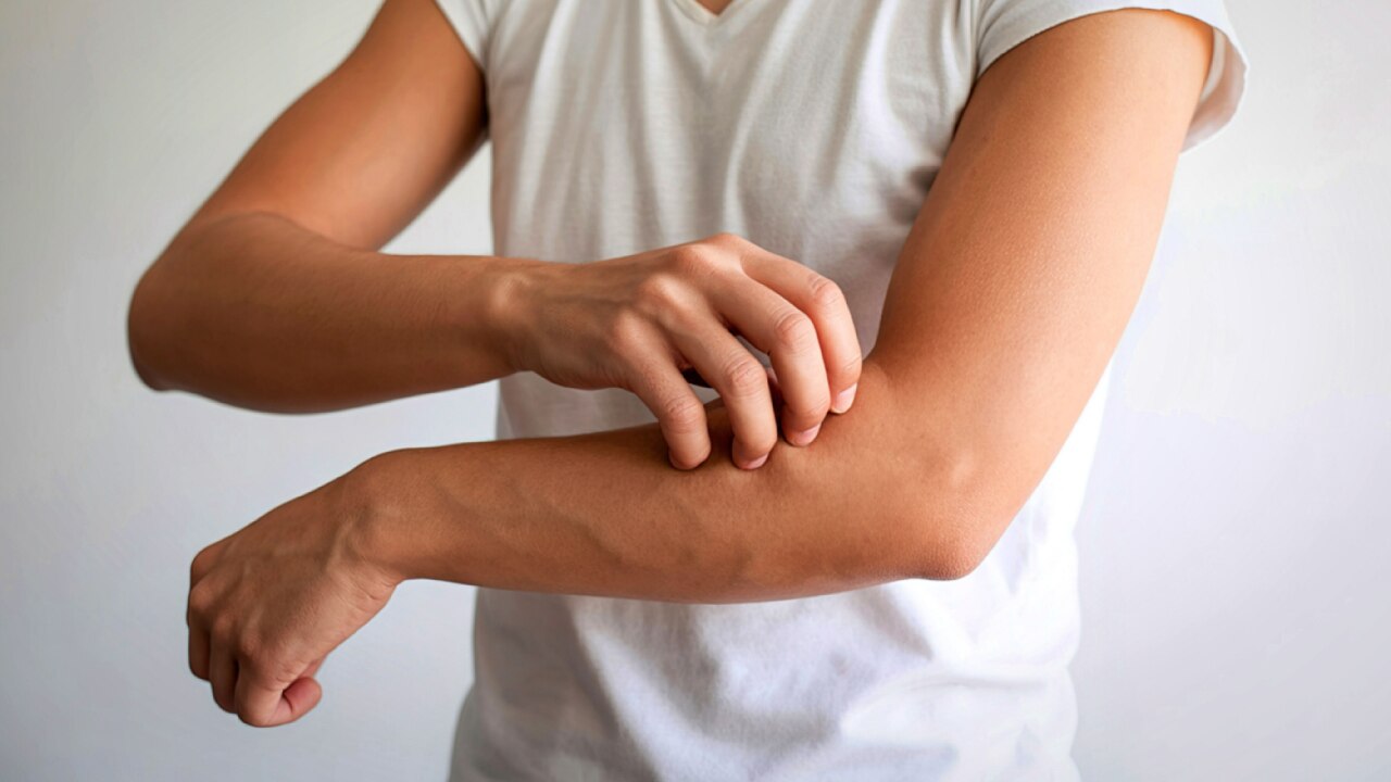 Skin Light Sensitivity: