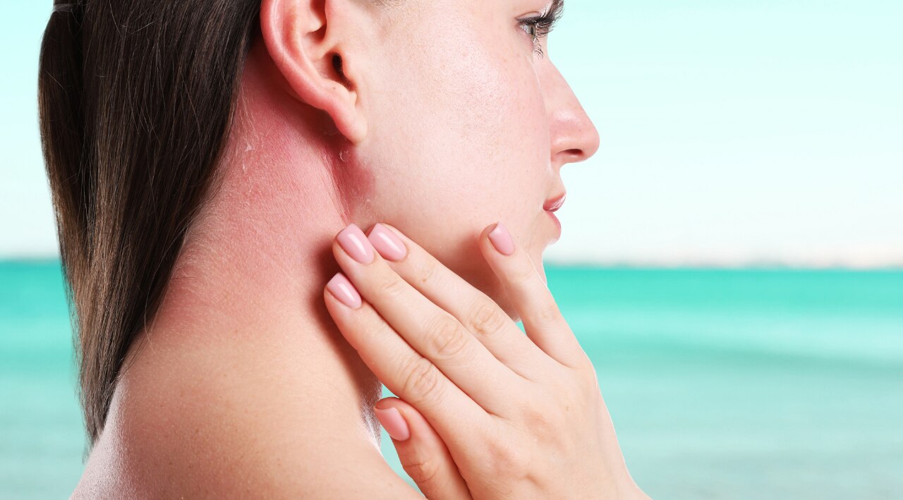 Why Holi Colours Can Damage Skin