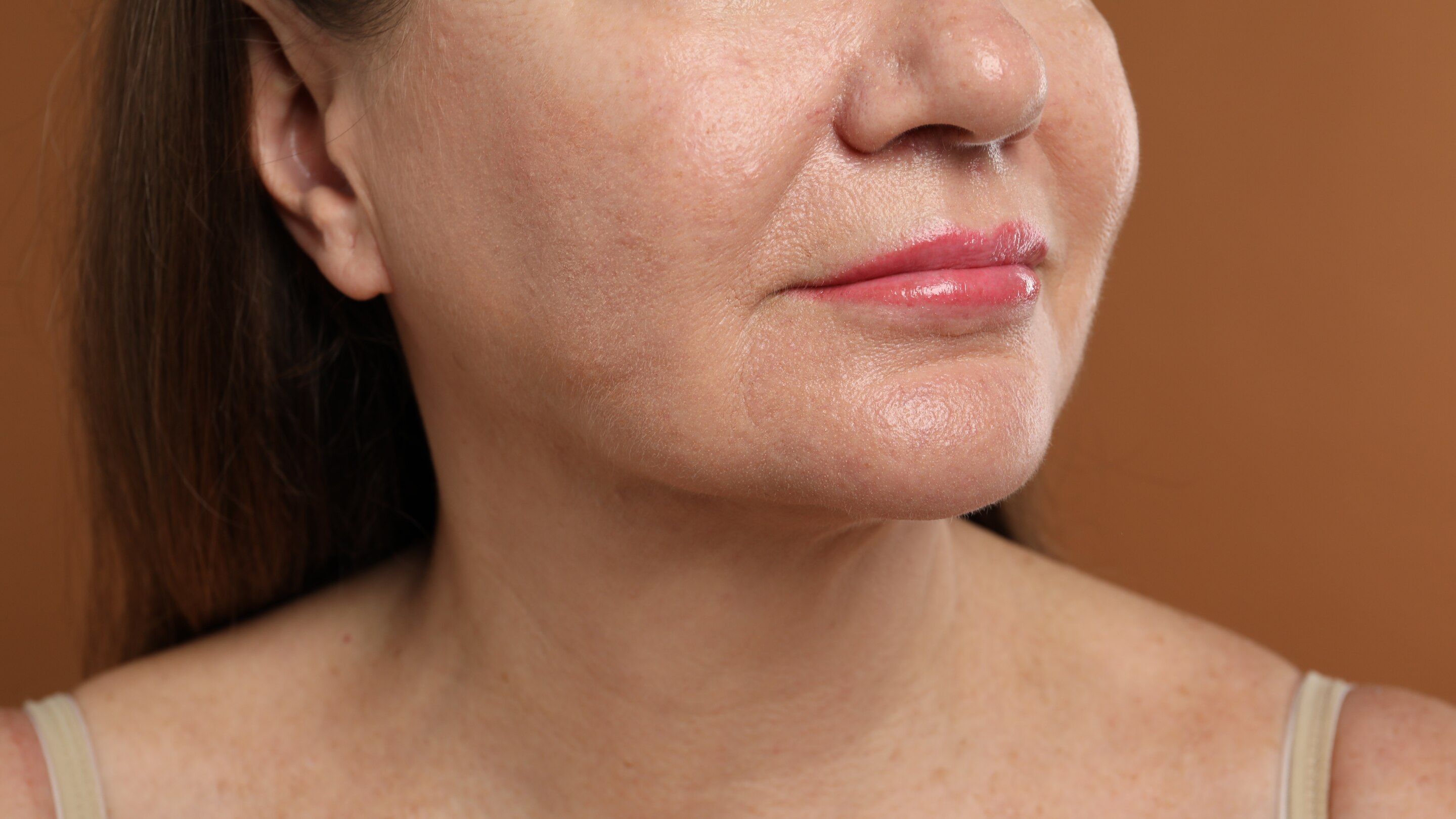 4. Fades Hyperpigmentation: