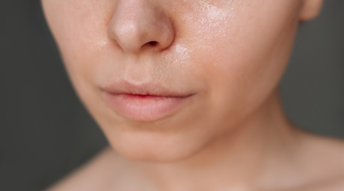 Dermatologist Recommended Skin Care Routine for Oily Skin