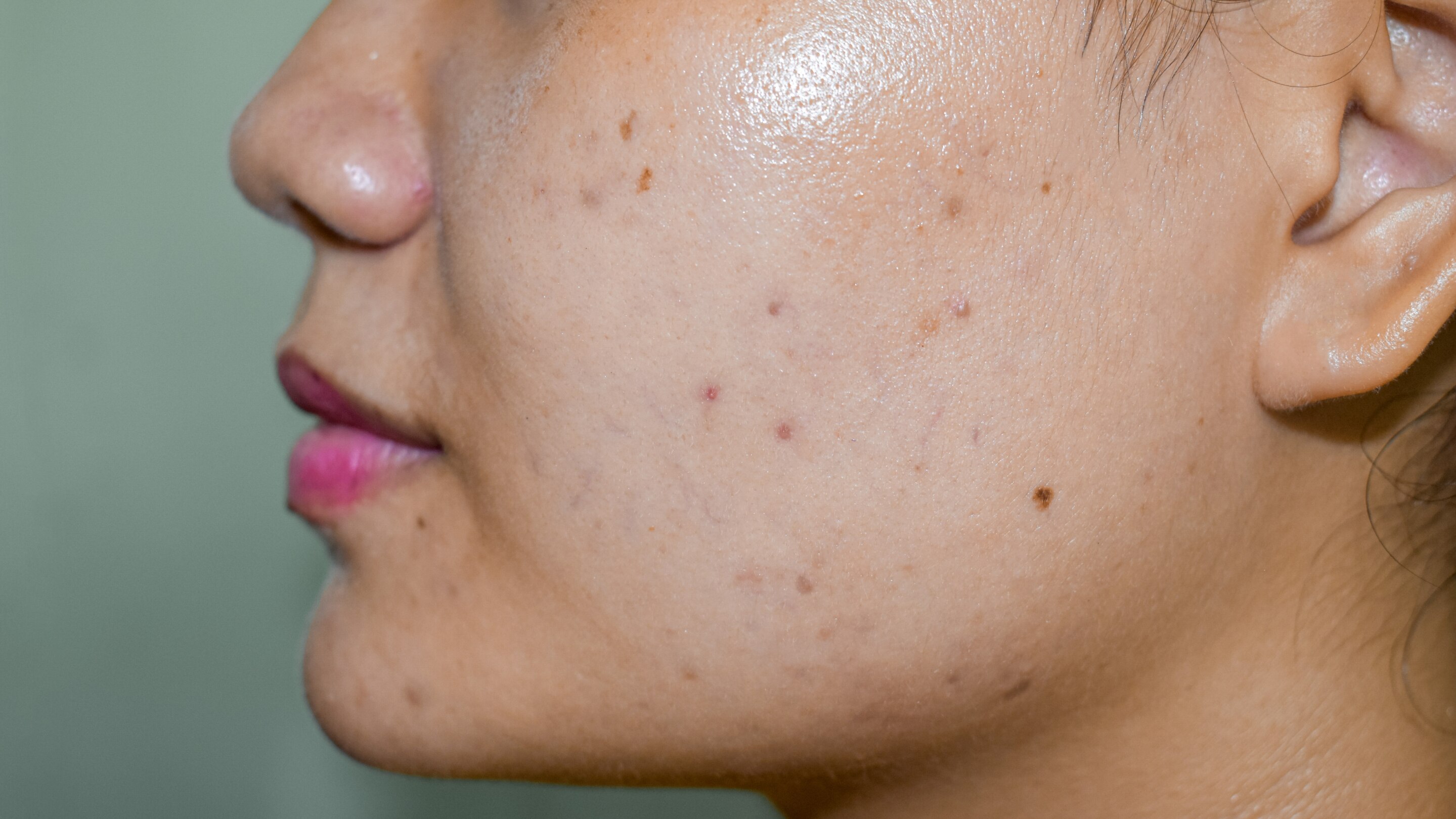 5. Oily Skin Control
