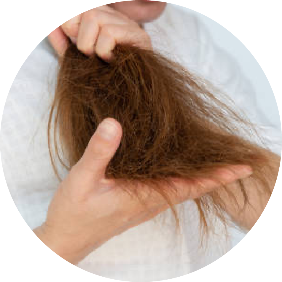 Hair concern from consuers