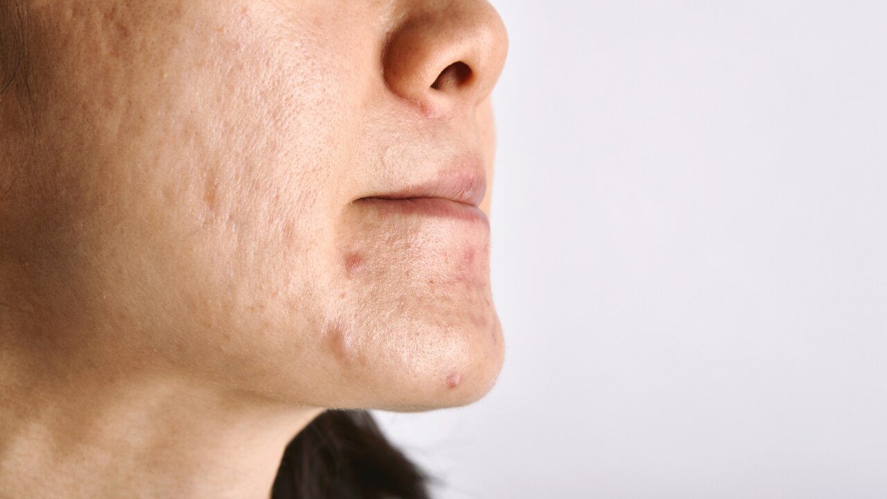 4. Protects Skin from Environmental Stress: