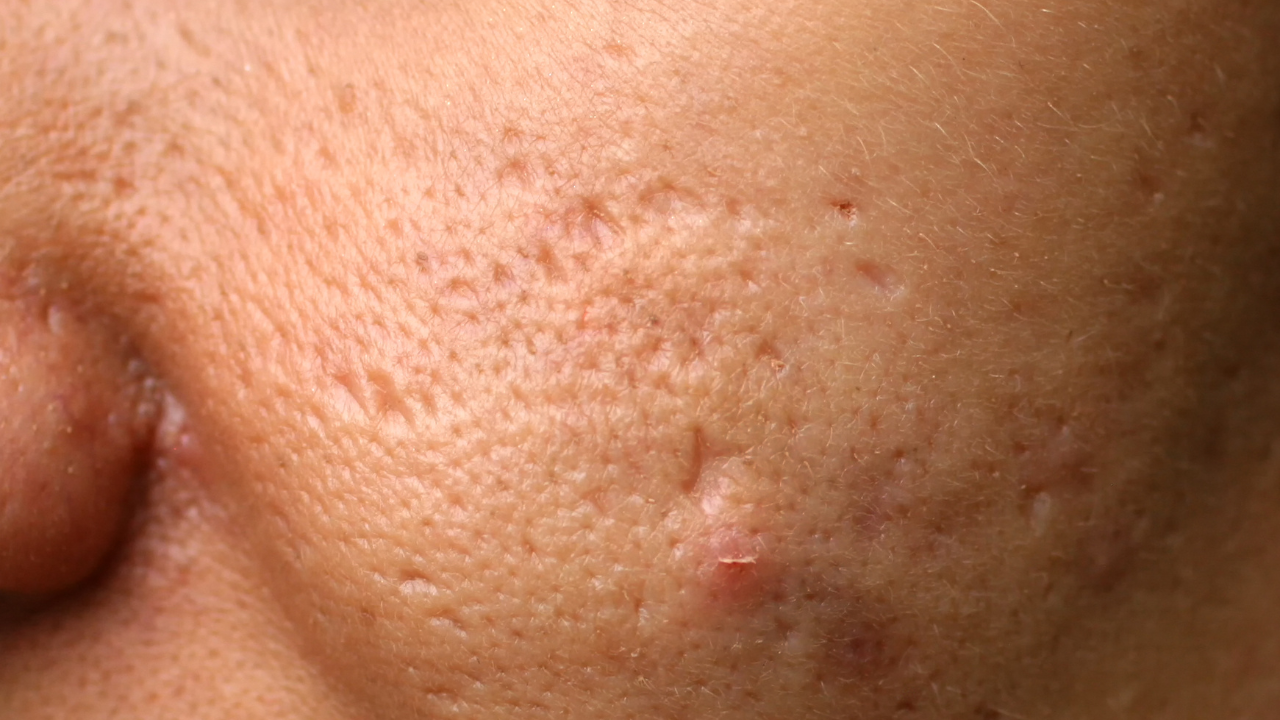7. May Reduce Mild Inflammation
