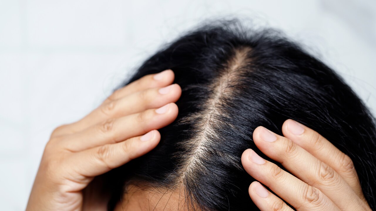Step 2: Section your hair