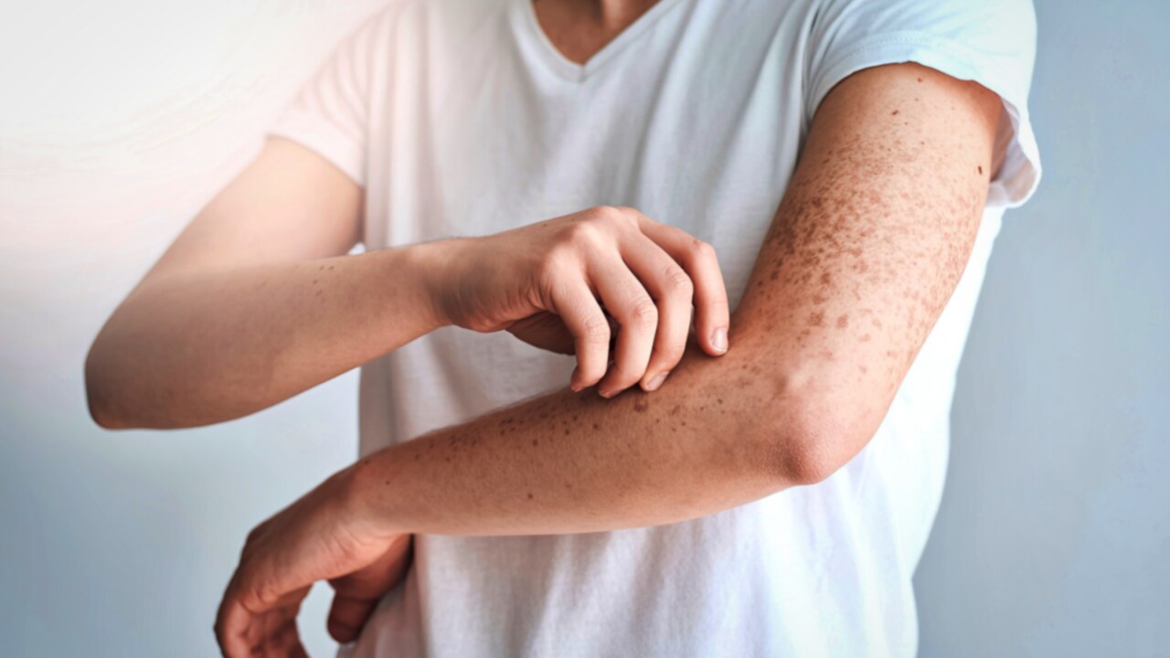 9. May Reduce Inflammation