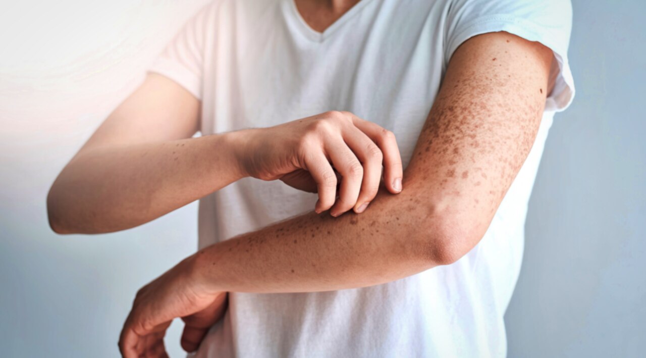 9. May Reduce Inflammation