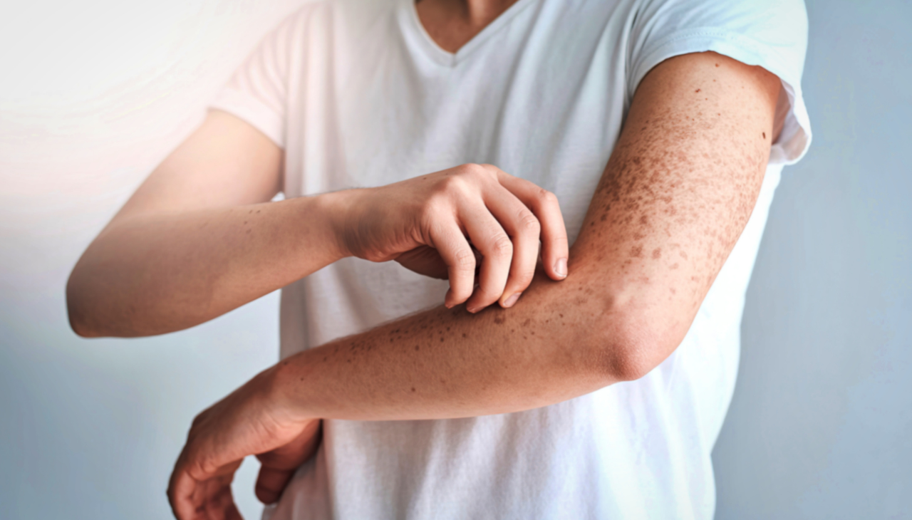 9. May Reduce Inflammation