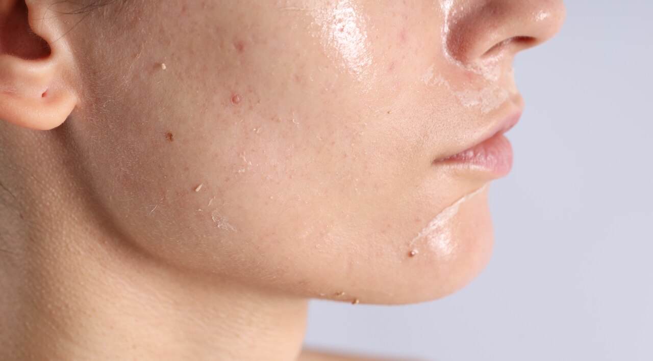 For Combination Skin: