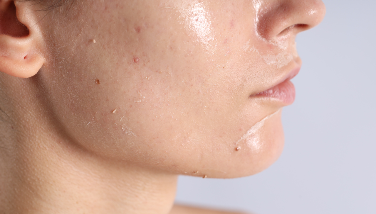 For Combination Skin: