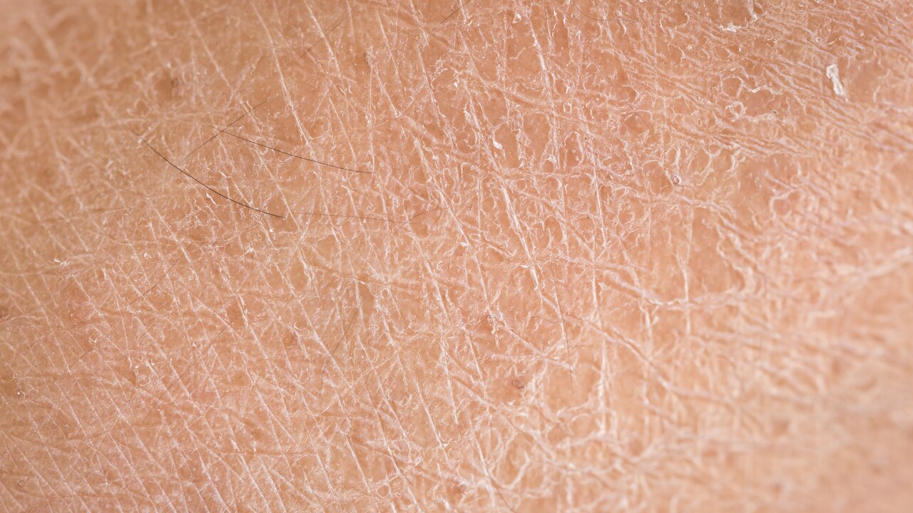For Dry Skin:
