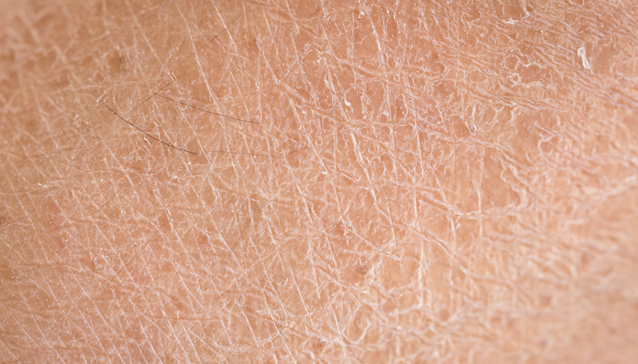 Best for Dry Textured Skin