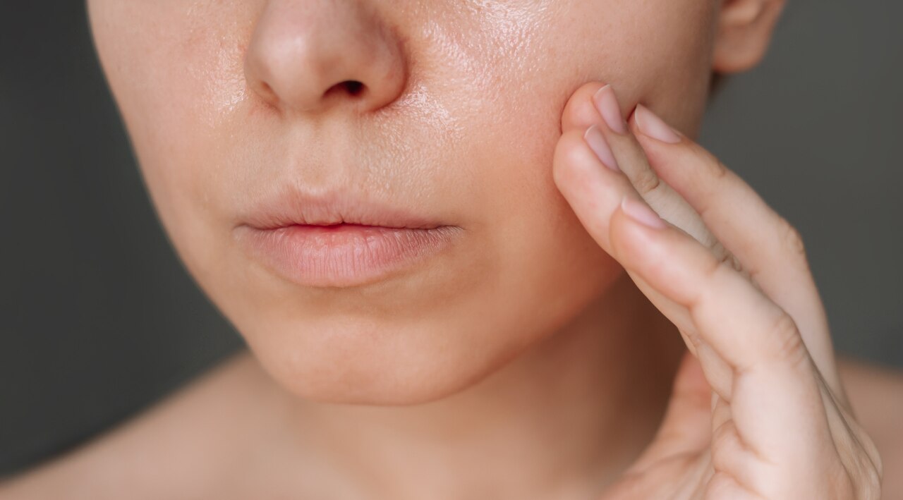 Sebum Increase: