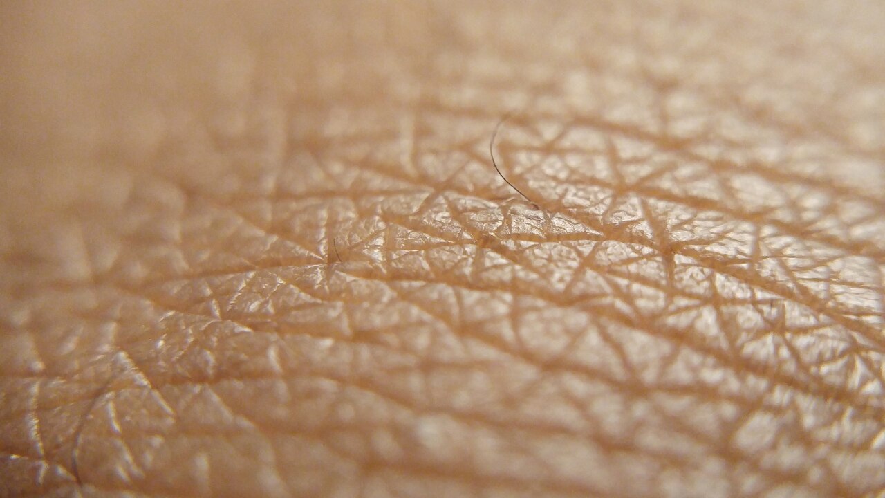 Dry Skin