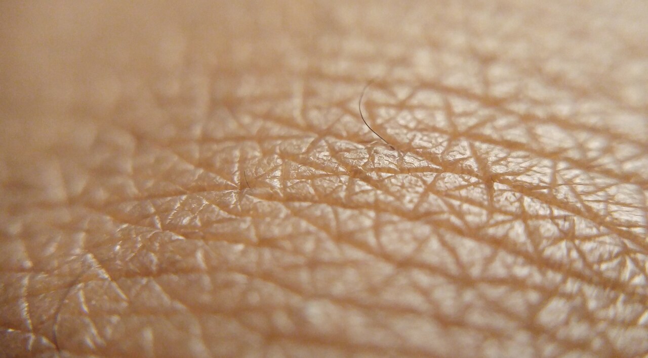 Dry Skin
