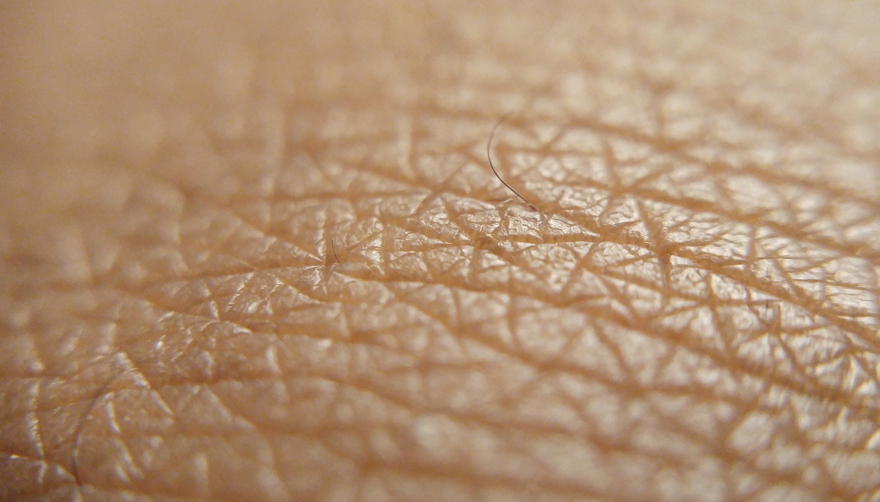 Dry Skin