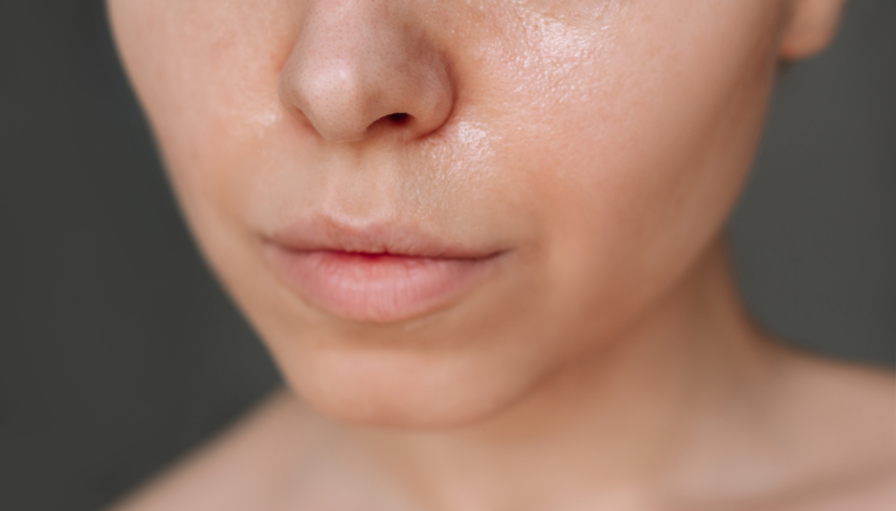 Oily Skin