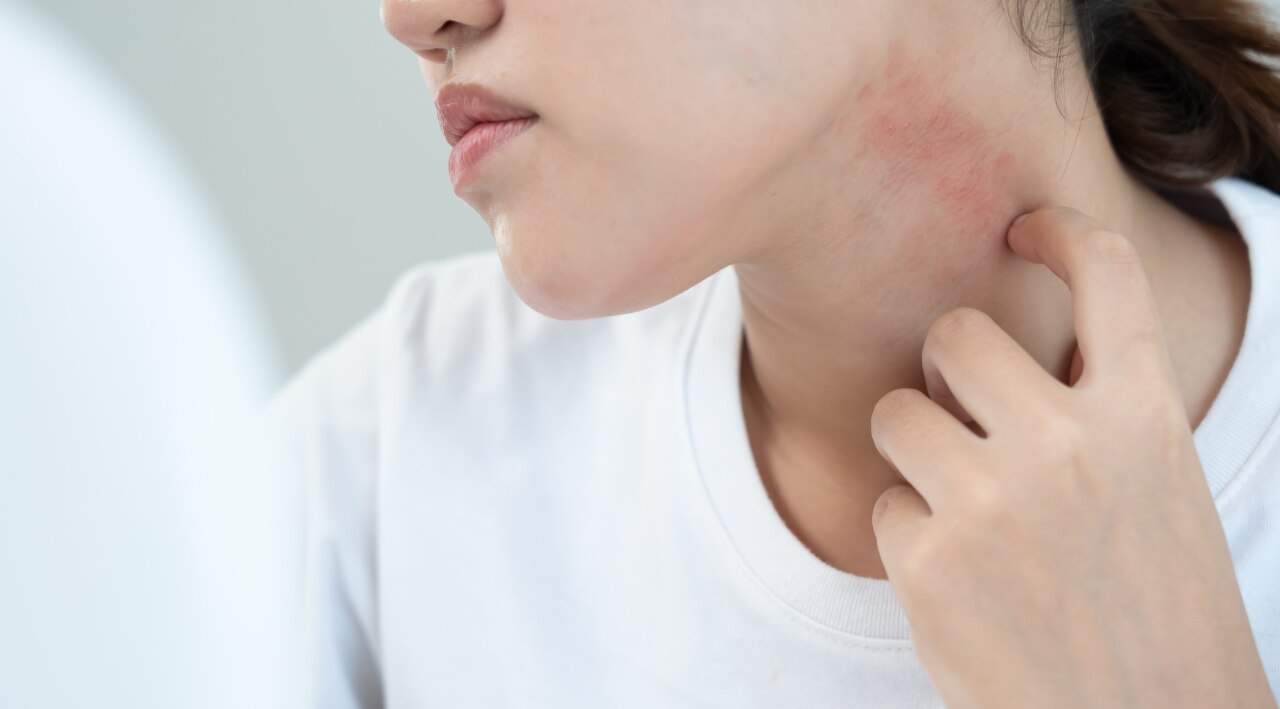 Sensitive Skin
