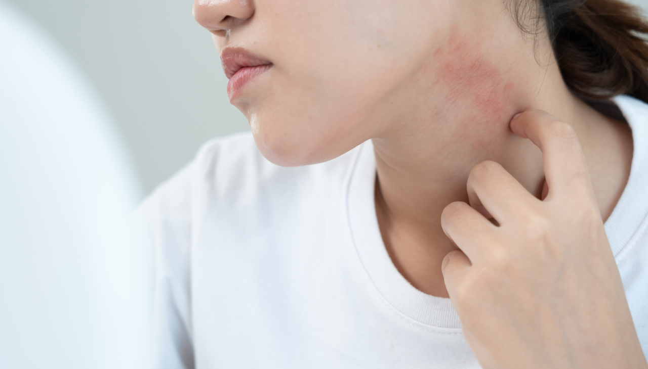 Sensitive Skin
