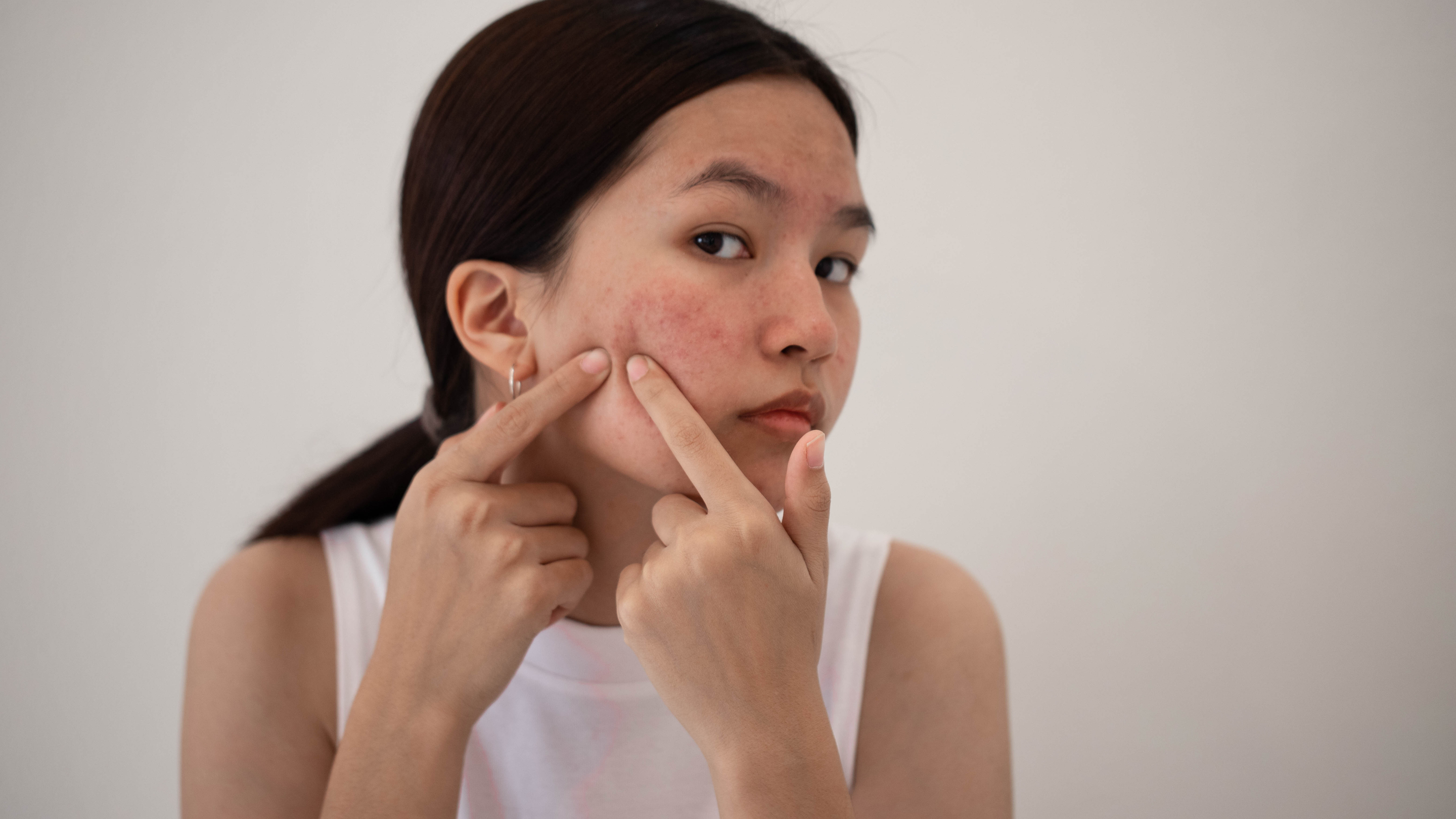 Who Should Avoid Using Coconut Oil on Eyebrows