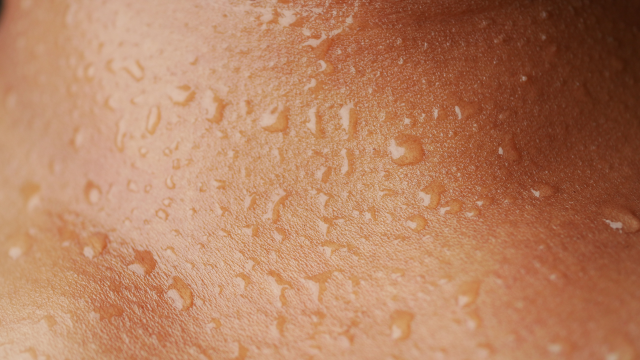 7. Deep Hydration: