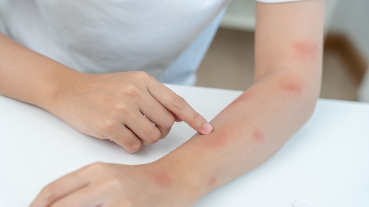 5. May soothe irritated skin: