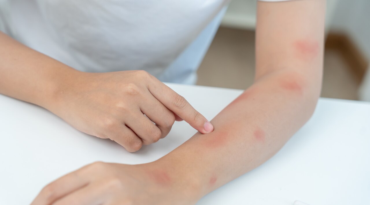 5. May soothe irritated skin: