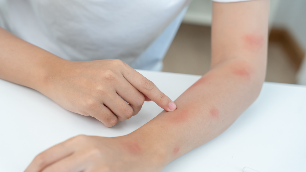 5. May soothe irritated skin: