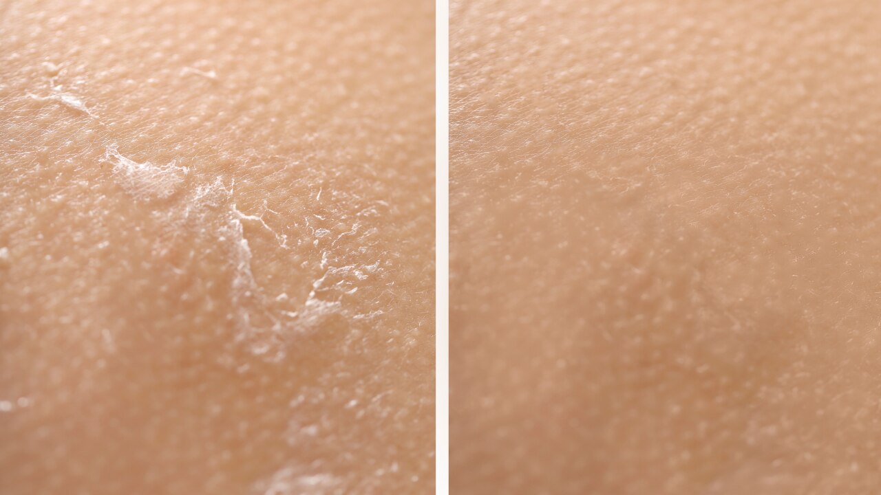 9. Softens Texture: