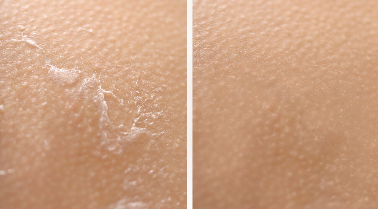 9. Softens Texture: