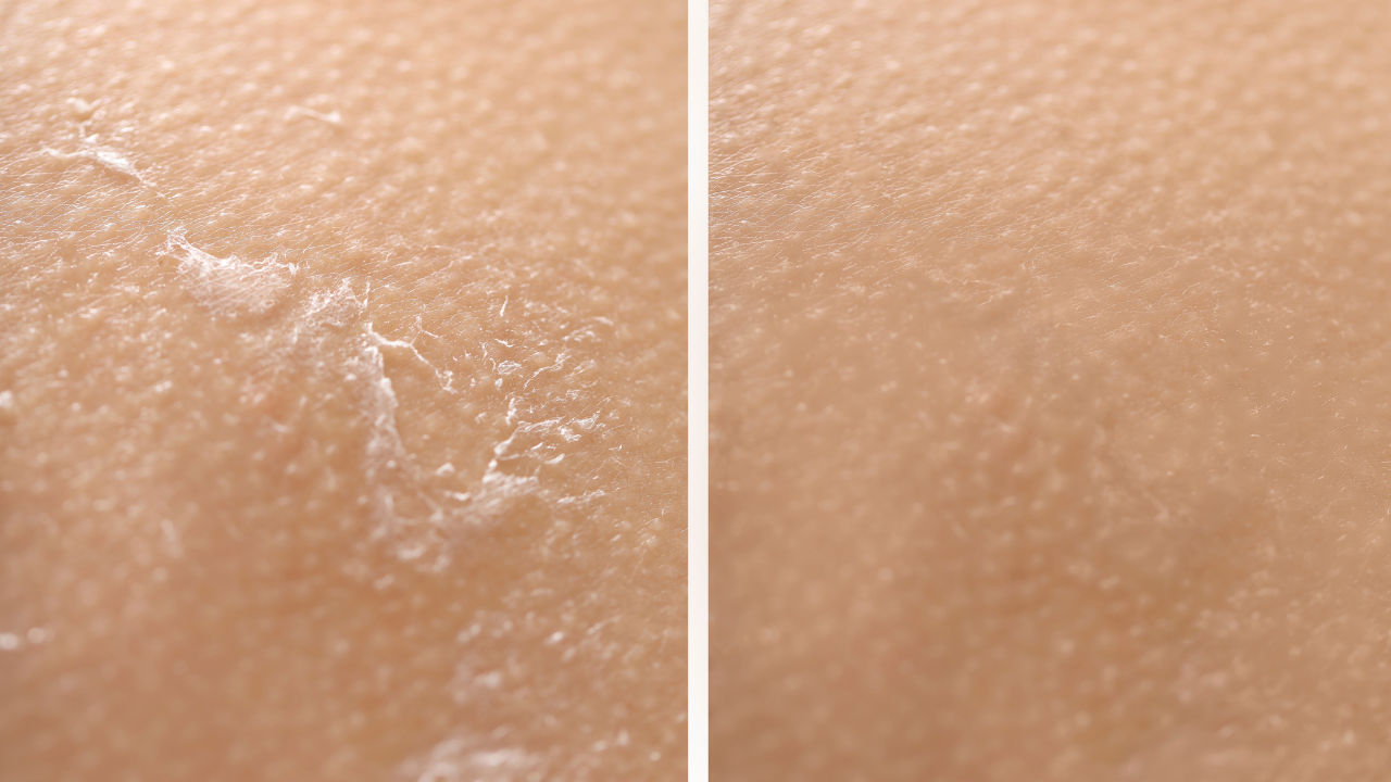 9. Softens Texture: