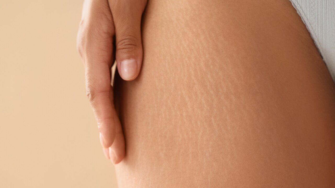 1. Targeted Scar and Stretch Mark Care: