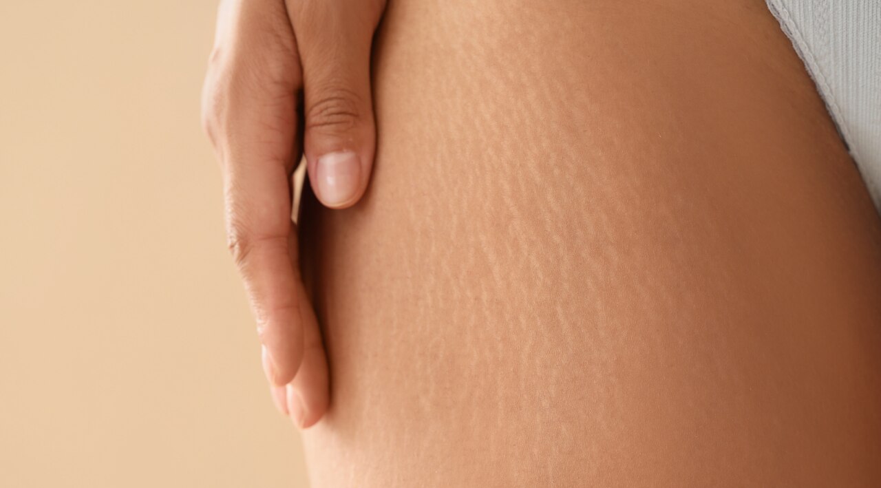 1. Targeted Scar and Stretch Mark Care: