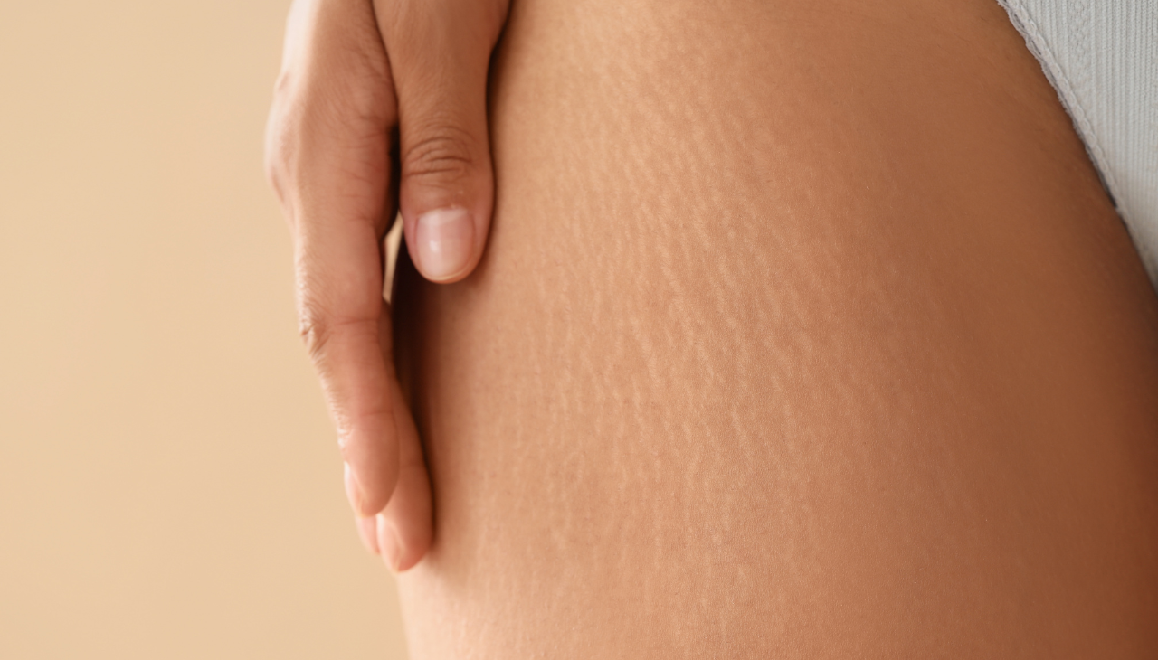1. Targeted Scar and Stretch Mark Care: