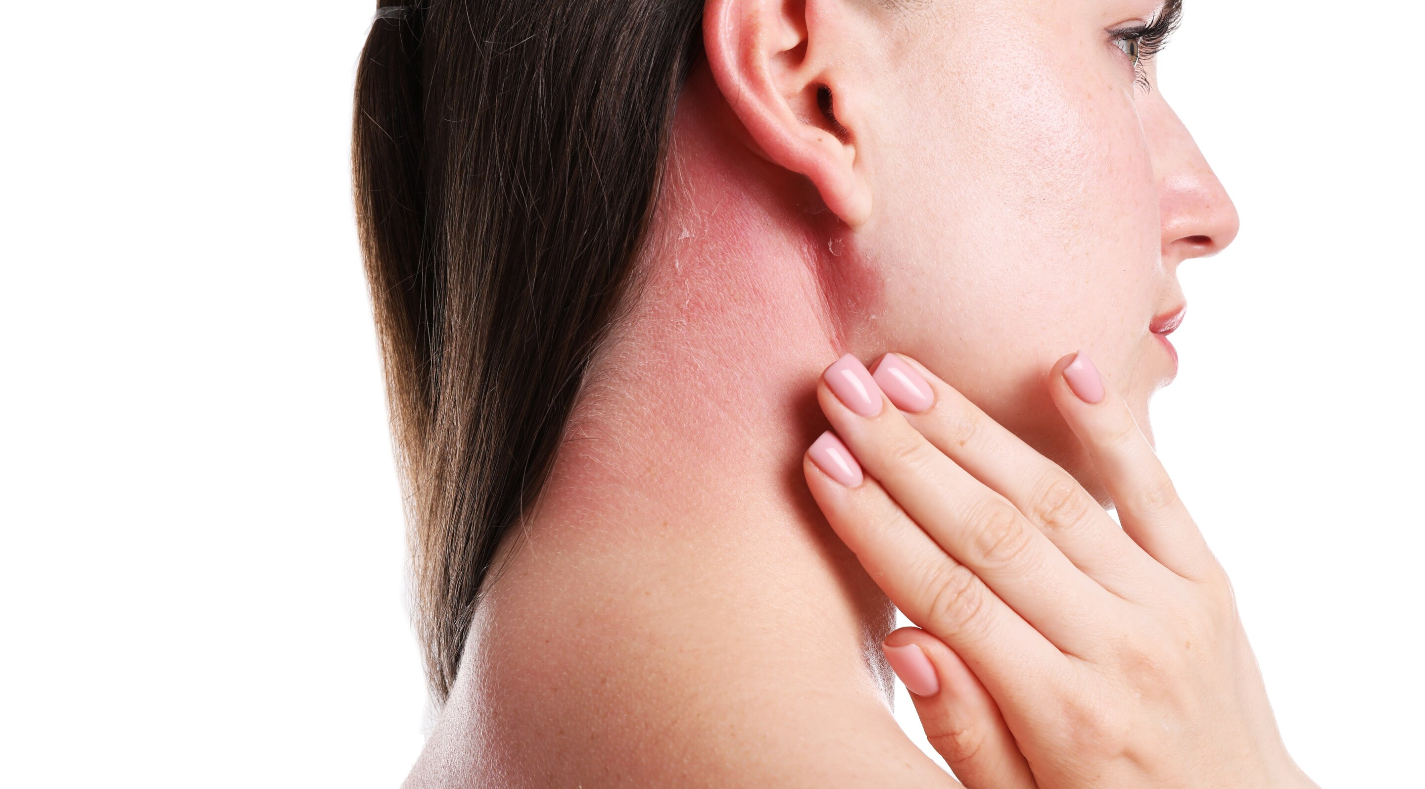 4. Soothes Skin Irritation