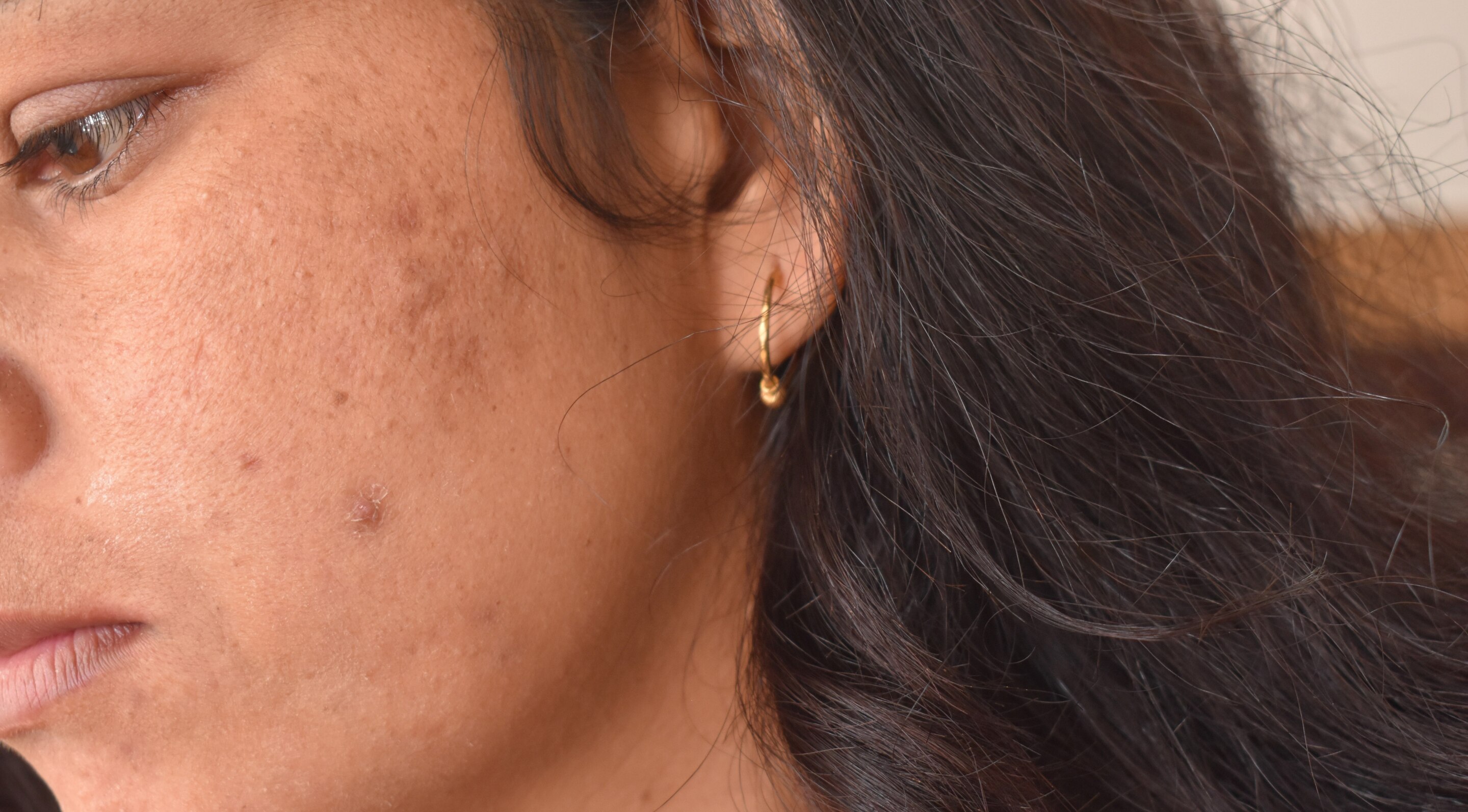 Possible Side Effects of Mulethi Powder