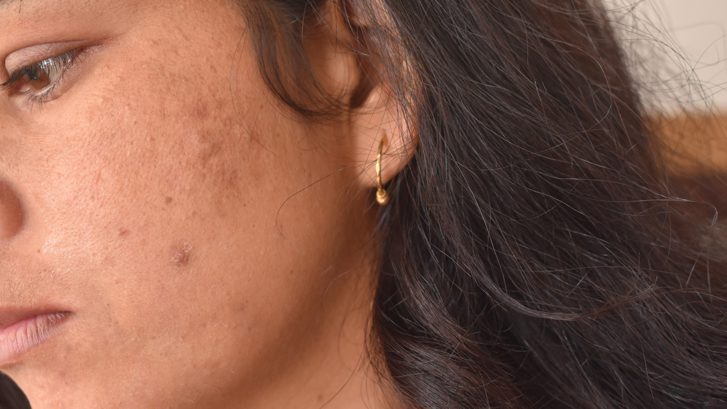 Possible Side Effects of Mulethi Powder