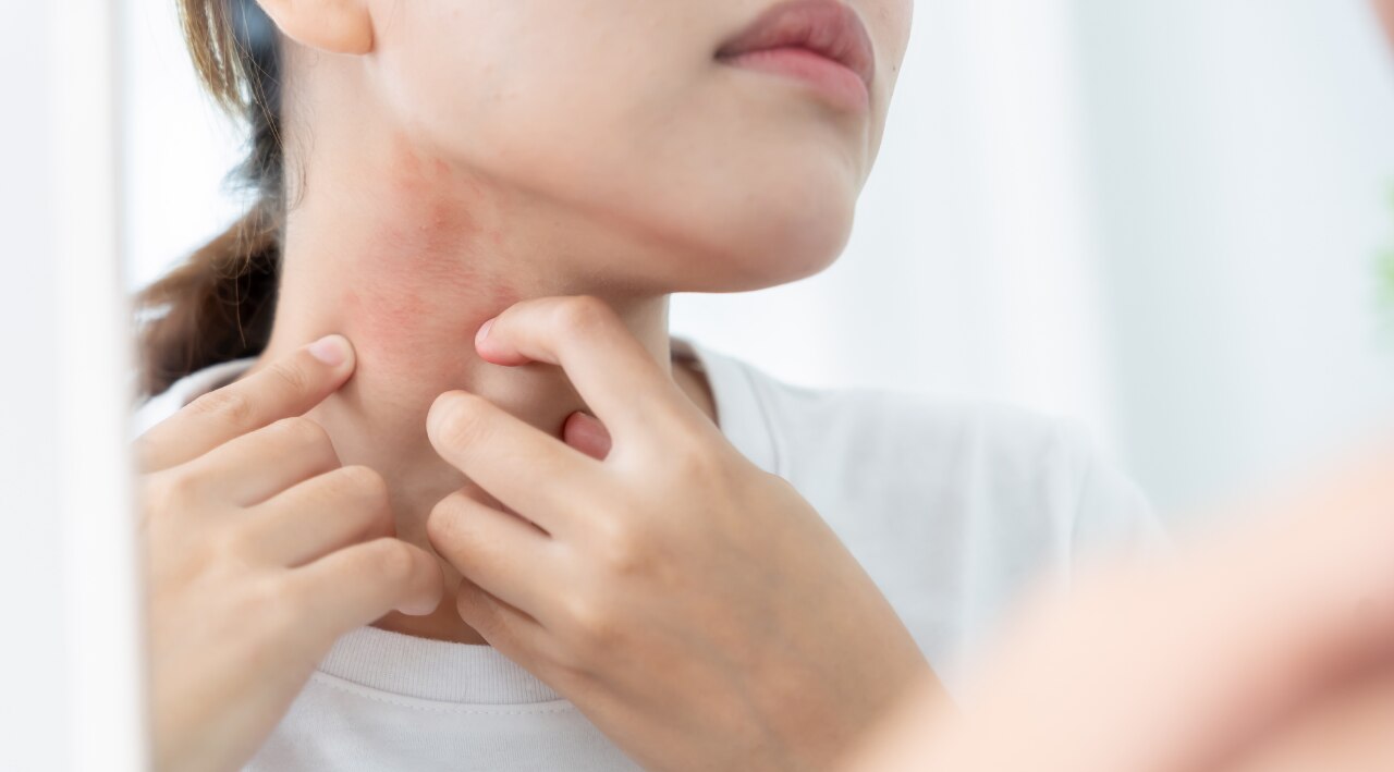 Anti-Inflammatory Properties