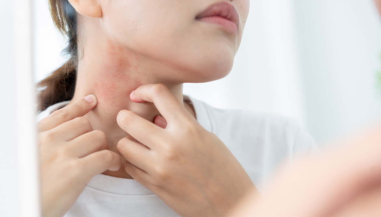 Anti-Inflammatory Properties