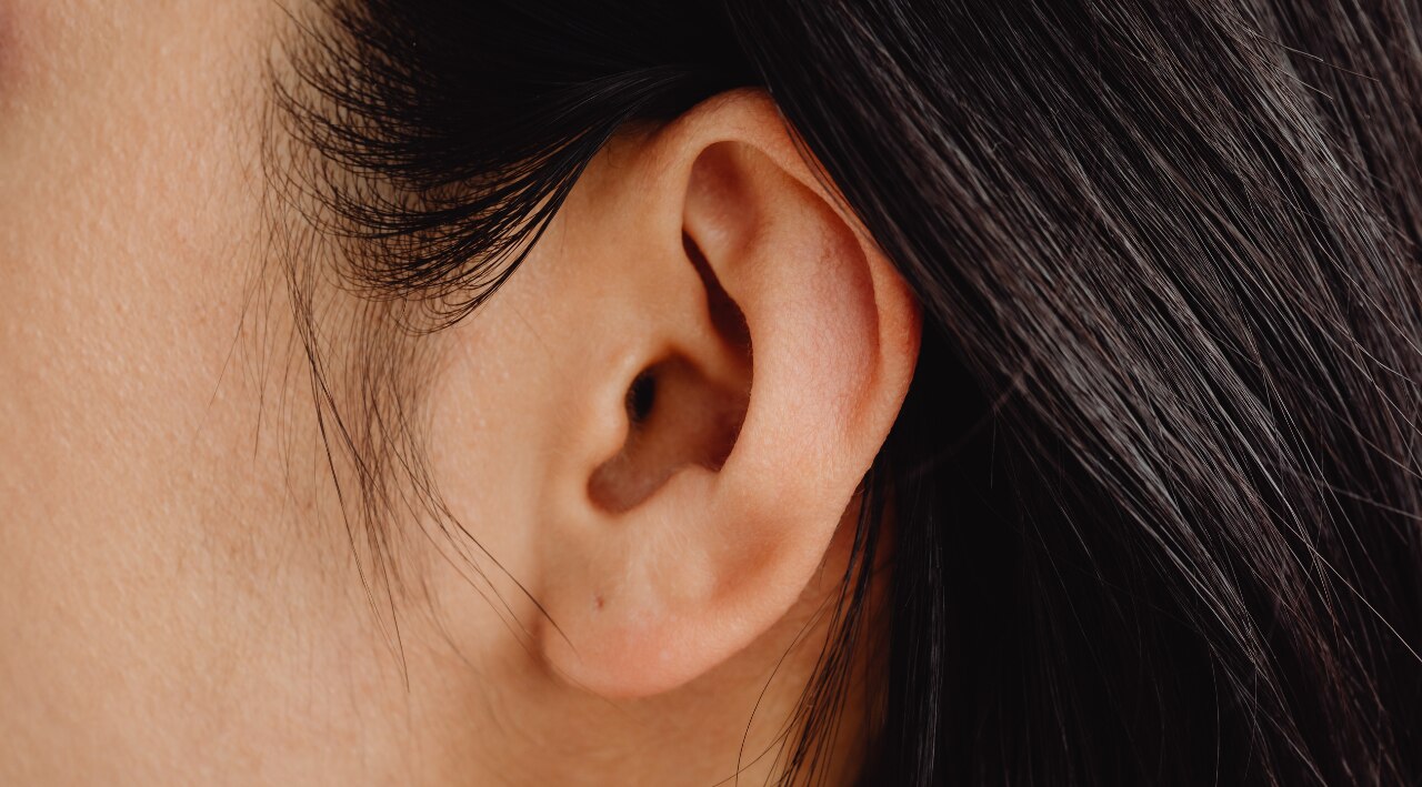 2. Perform a patch test