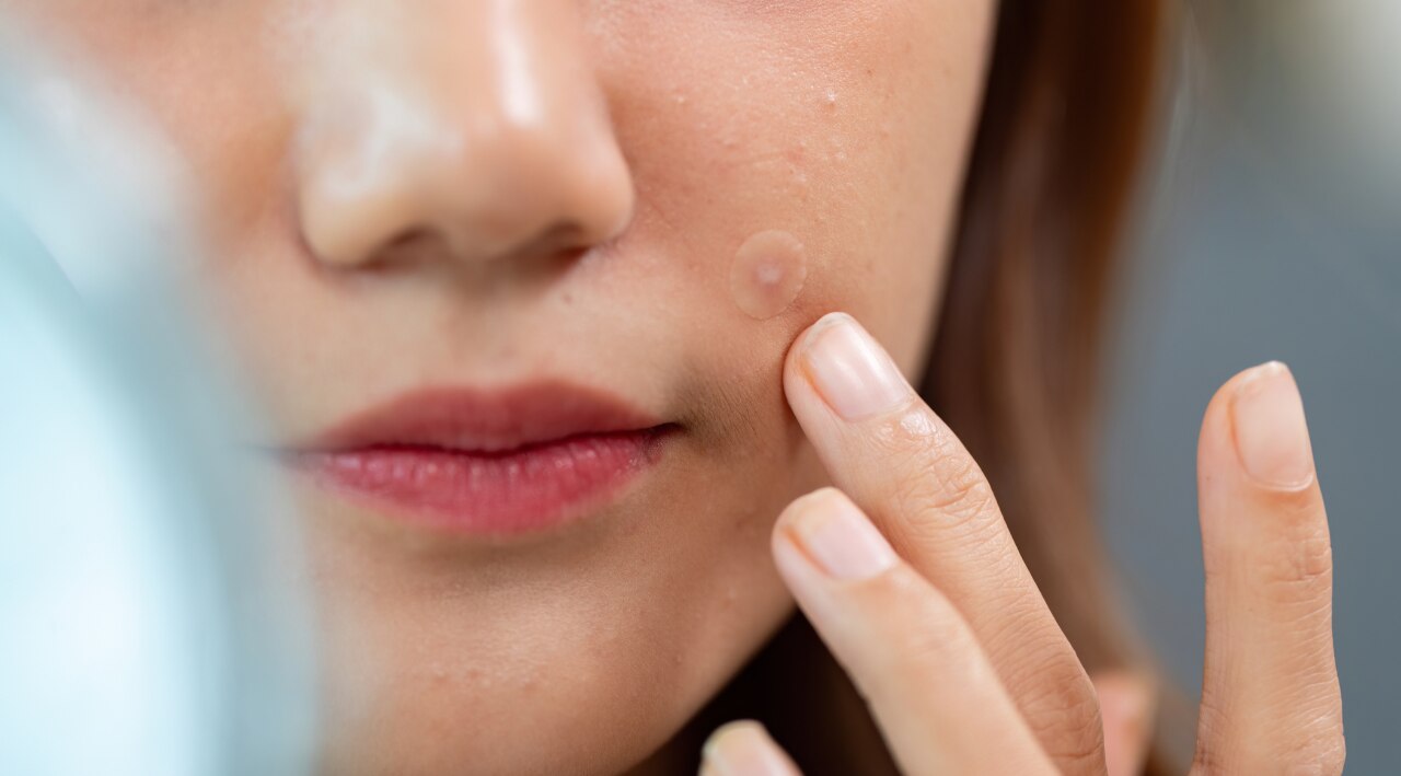Possible Side Effects of Vitamin E Capsule