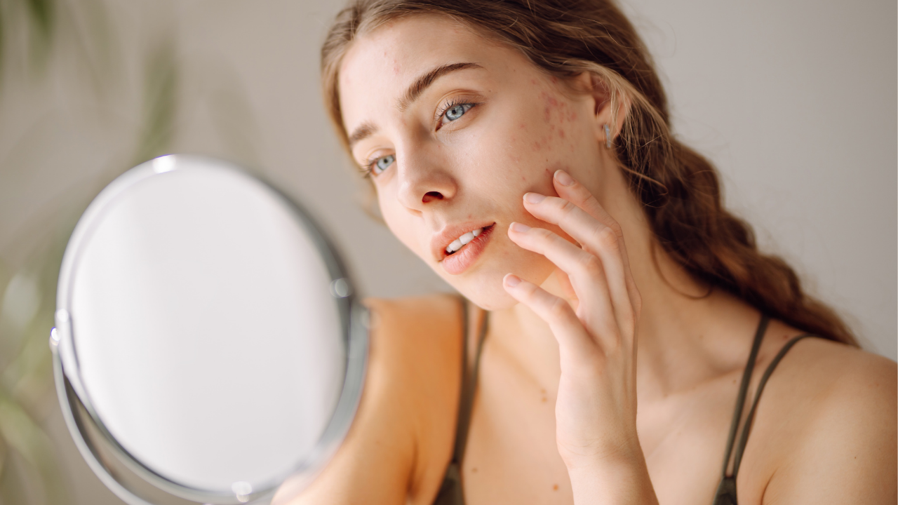 9. Scar and Blemish Healing