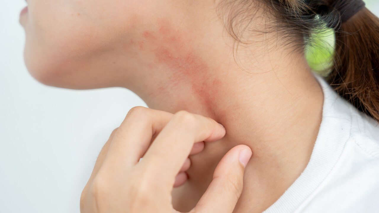 Who Should Avoid Using Papaya on Face