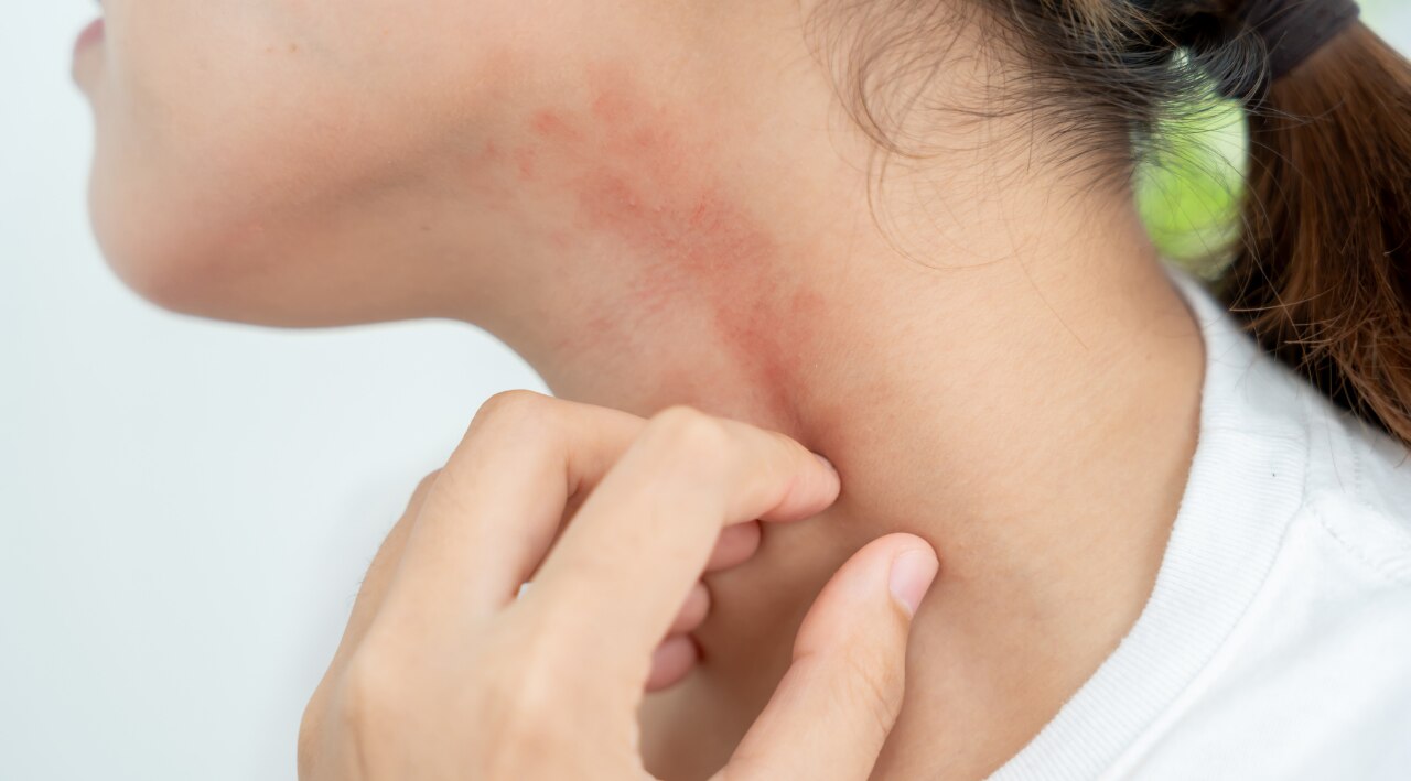 Who Should Avoid Using Papaya on Face