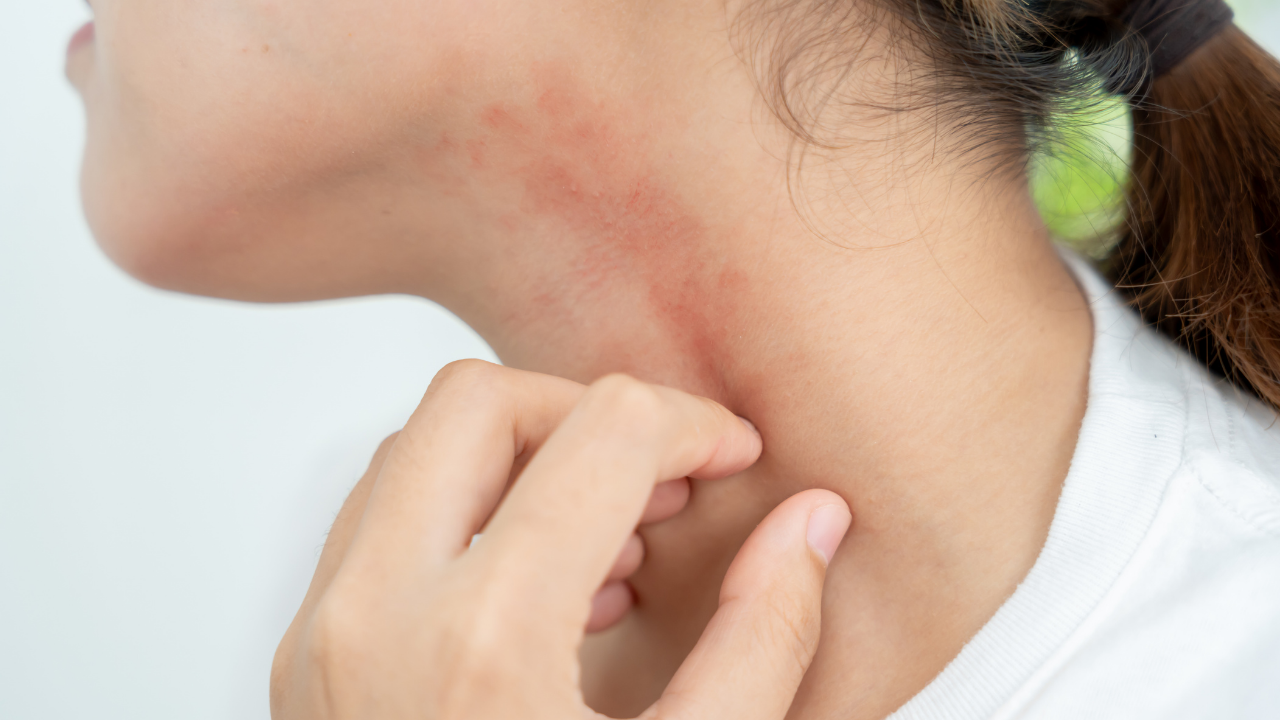 Who Should Avoid Using Papaya on Face