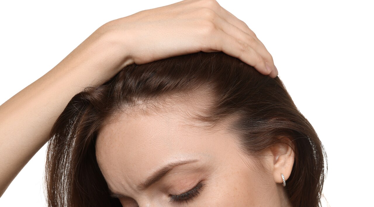 For Alopecia or Bald Patches: