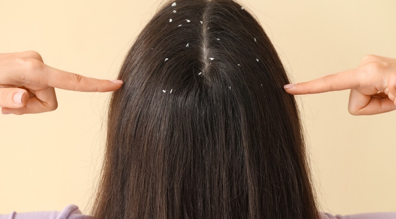 For Oily Scalp with Flakes: