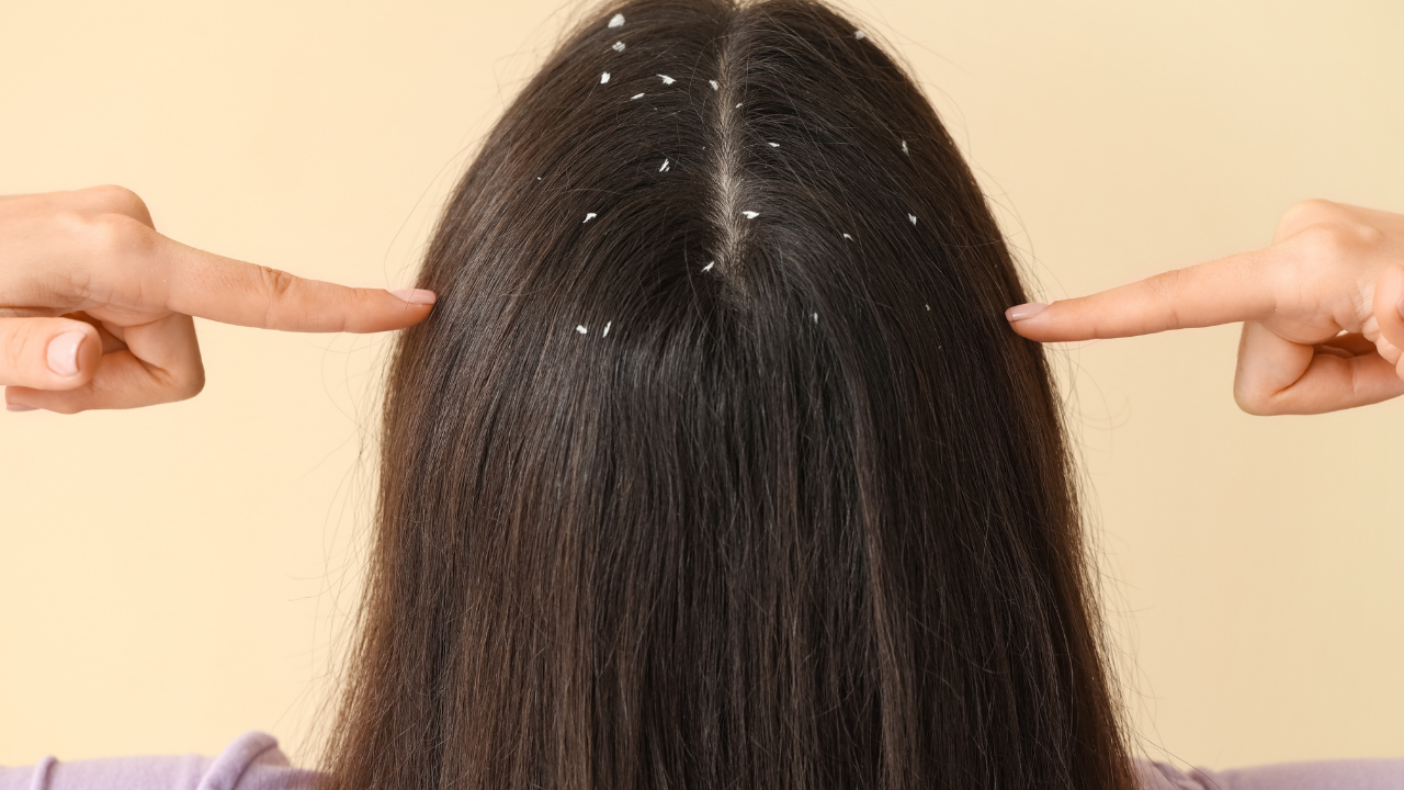 For Oily Scalp with Flakes: