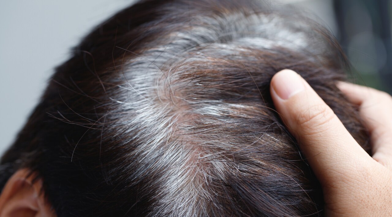 For Premature Greying and Dull Hair:
